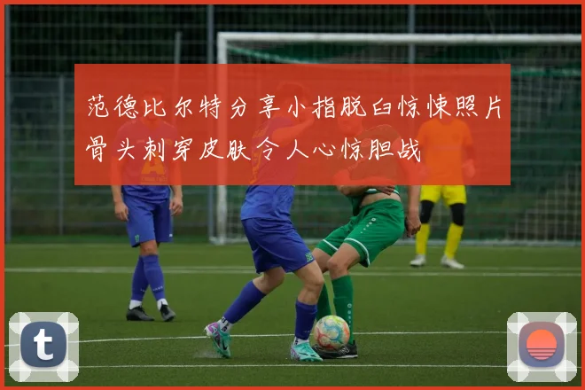范德比尔特分享小指脱臼惊悚照片骨头刺穿皮肤令人心惊胆战